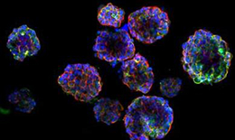 首個(gè)鼻咽癌3D類器官模型!用于精確的治療輻射劑